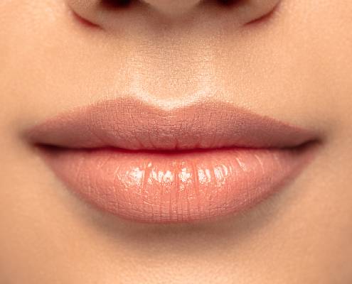 Bullhorn-Lift (Lip Lift) » Kleiner Eingriff, volle Lippen